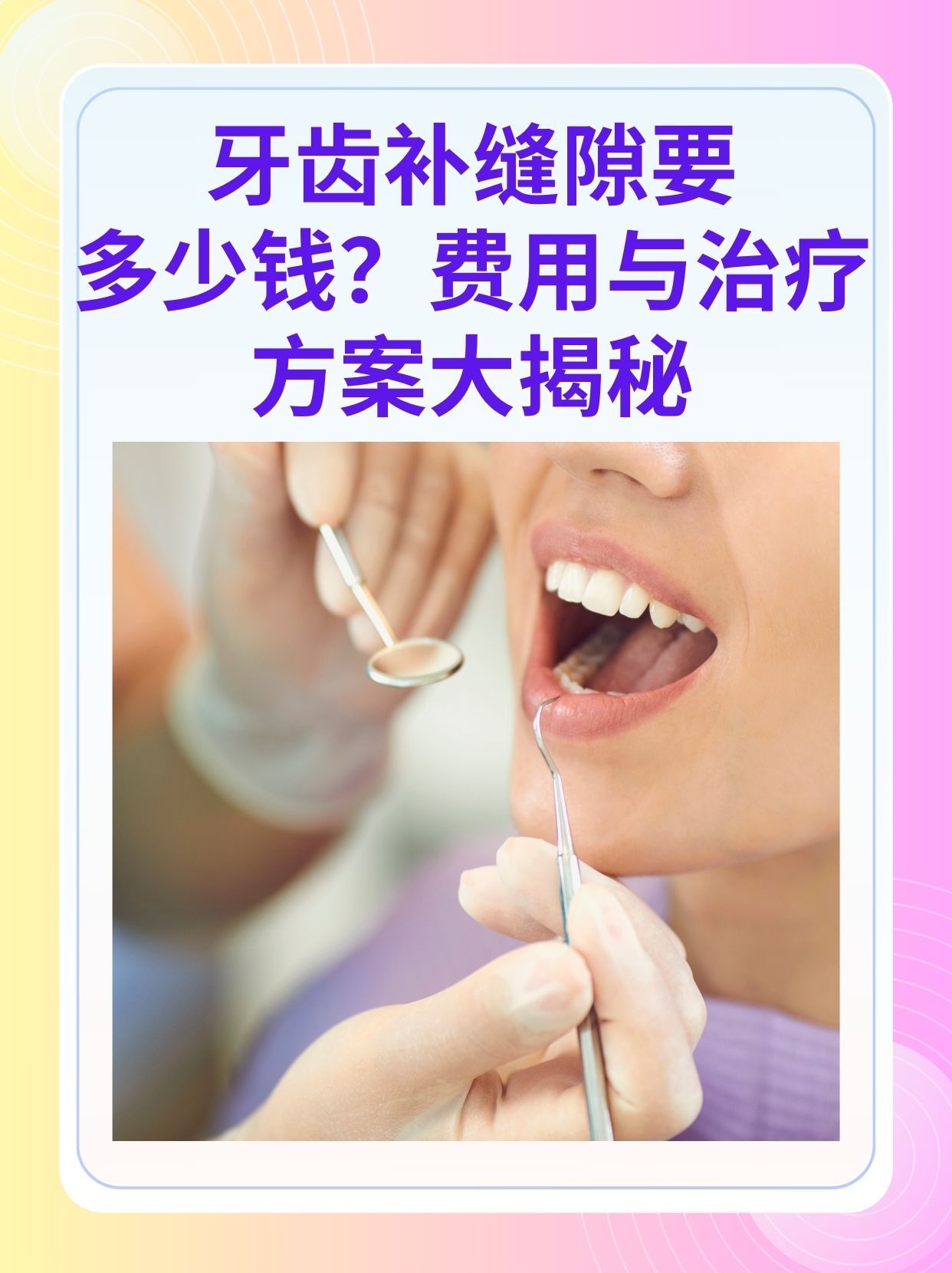 东方补牙医保可以报销吗(补牙医保可以报销吗 哪些可以报销呢)